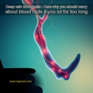 Read more about the article Deep vein thrombosis : Here why you should worry about blood clots if you sit for too long